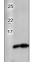 TrxM1/M2 | Thioredoxin  M1/M2 (chloroplastic) in the group Antibodies for Plant/Algal  / Photosynthesis  / RUBISCO/Carbon metabolism at Agrisera AB (Antibodies for research) (AS14 2809)